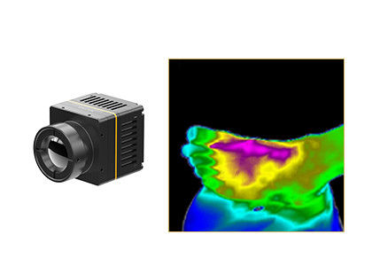 Μη ψυχόμενη θερμική ενότητα 384x288 17μM για τη Thermographic ιατρική υγειονομική περίθαλψη